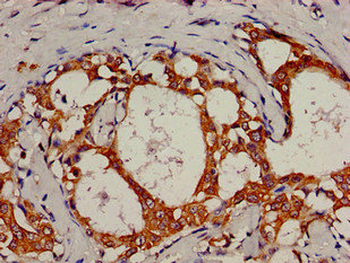 KRT18 Antibody
