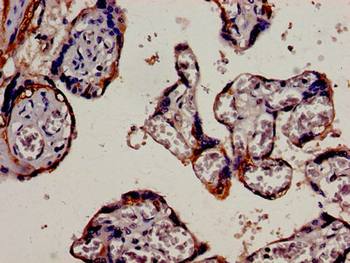 KRT18 Antibody