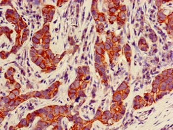KRT18 Antibody (Biotin)