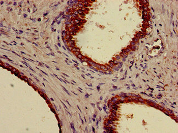 KRT18 Antibody (Biotin)