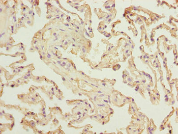 RAD23A Antibody