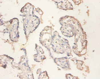 RPS11 Antibody