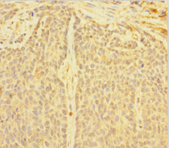 DNTTIP1 Antibody