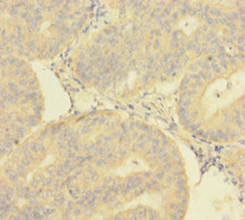 DNTTIP1 Antibody
