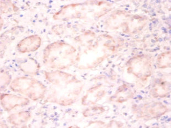H3F3A Antibody