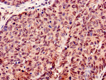 H3F3A Antibody