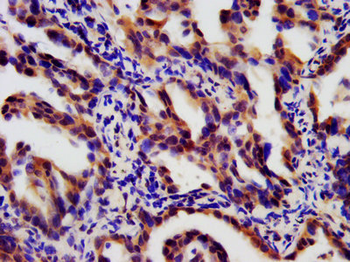 LTBR Antibody