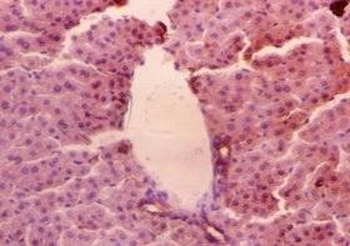 AGER Antibody