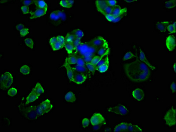 AGER Antibody