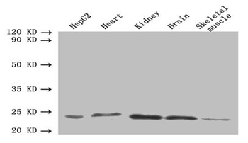 ORM2 Antibody