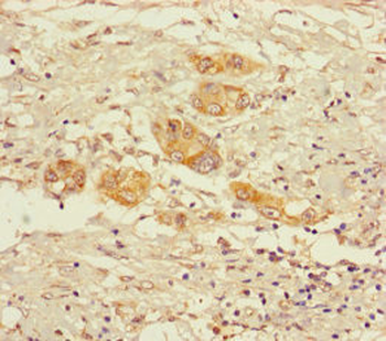 OGDH Antibody