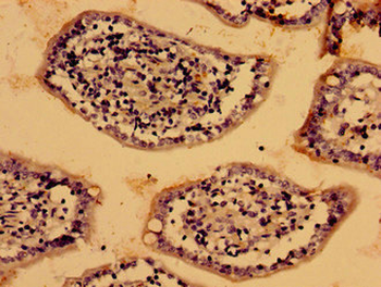 LIAS Antibody