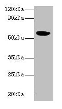 HARS2 Antibody