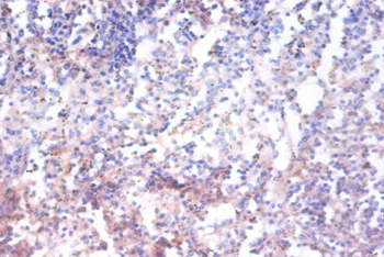 AHSA1 Antibody