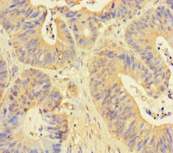 RPN1 Antibody