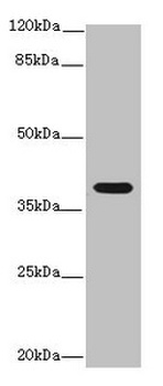 IL12B Antibody