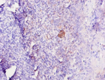 IL12B Antibody