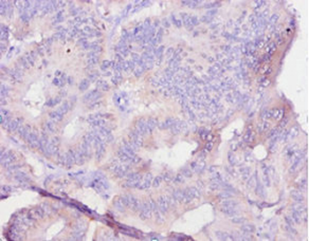 IL12B Antibody
