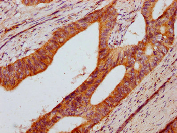 DUSP13 Antibody