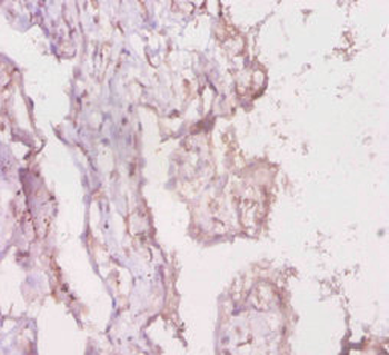 LRBA Antibody