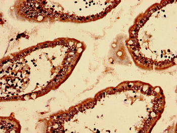 LRBA Antibody