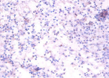 RELT Antibody