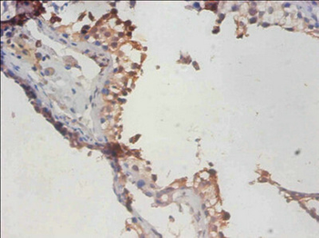 PHF5A Antibody