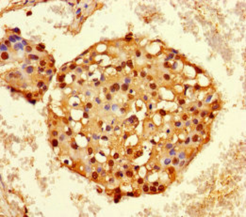HNRNPA2B1 Antibody