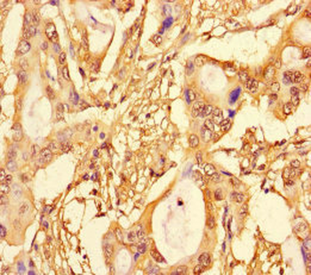 SUPT3H Antibody