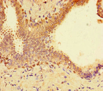 SUPT3H Antibody