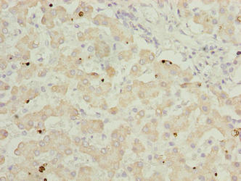 GOT2 Antibody