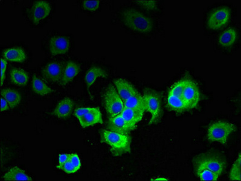 GOT2 Antibody