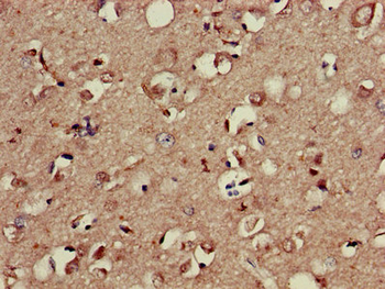 AP2M1 Antibody