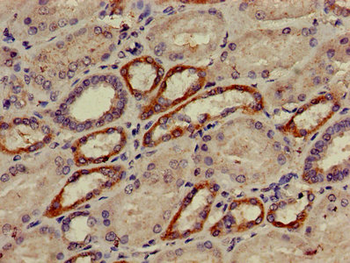 AP2M1 Antibody