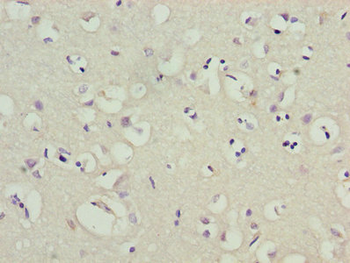 KCND1 Antibody