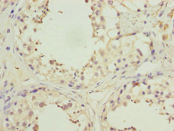 KCND1 Antibody