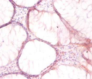 ATP6V1G1 Antibody
