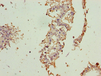 CRABP1 Antibody