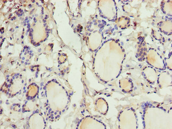 CRABP1 Antibody