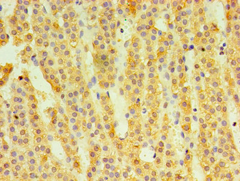 HSD11B1 Antibody