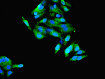 HSD11B1 Antibody