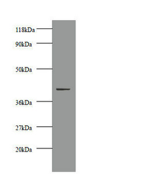 CKM Antibody