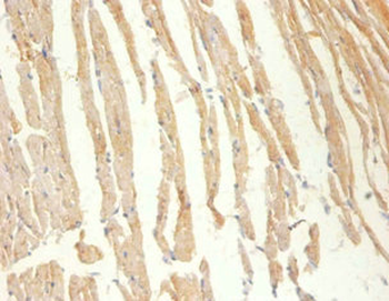 CKM Antibody