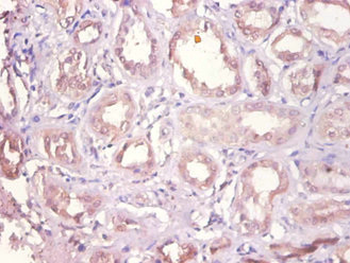 DHRS9 Antibody