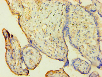 HNRNPH1 Antibody