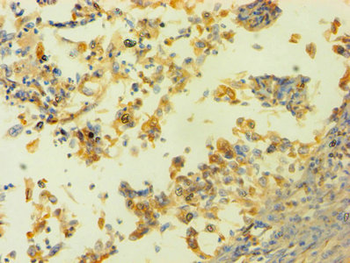 HNRNPH1 Antibody