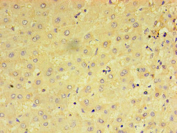 PRAME Antibody
