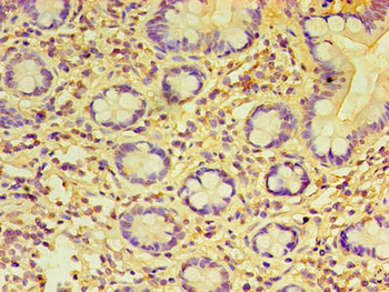 PRAME Antibody