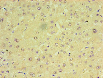 CHCHD4 Antibody