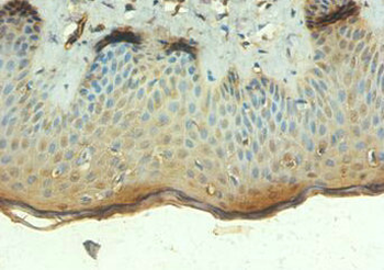 TEP1 Antibody